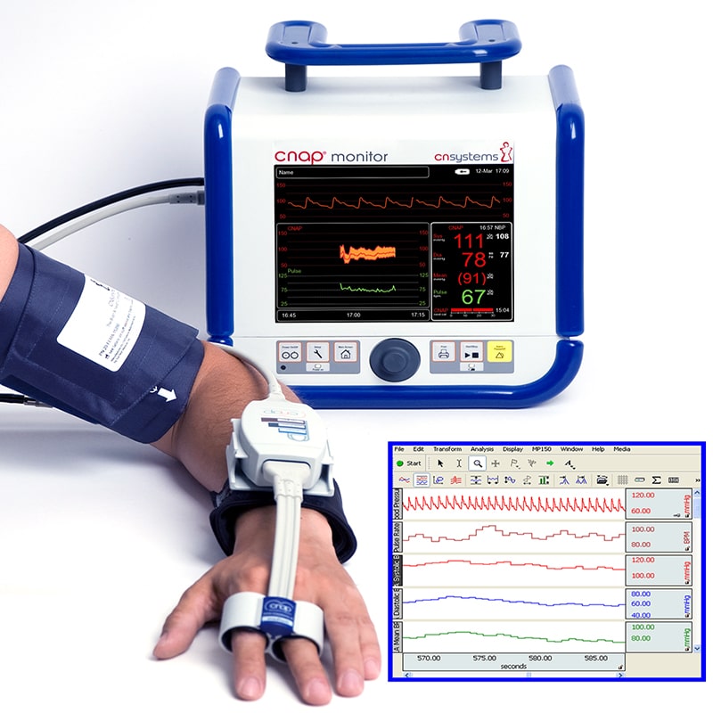 فشارسنج خوراکی (Intra-arterial Blood Pressure Monitoring):