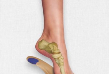 کفی ارتوپدی اوتک