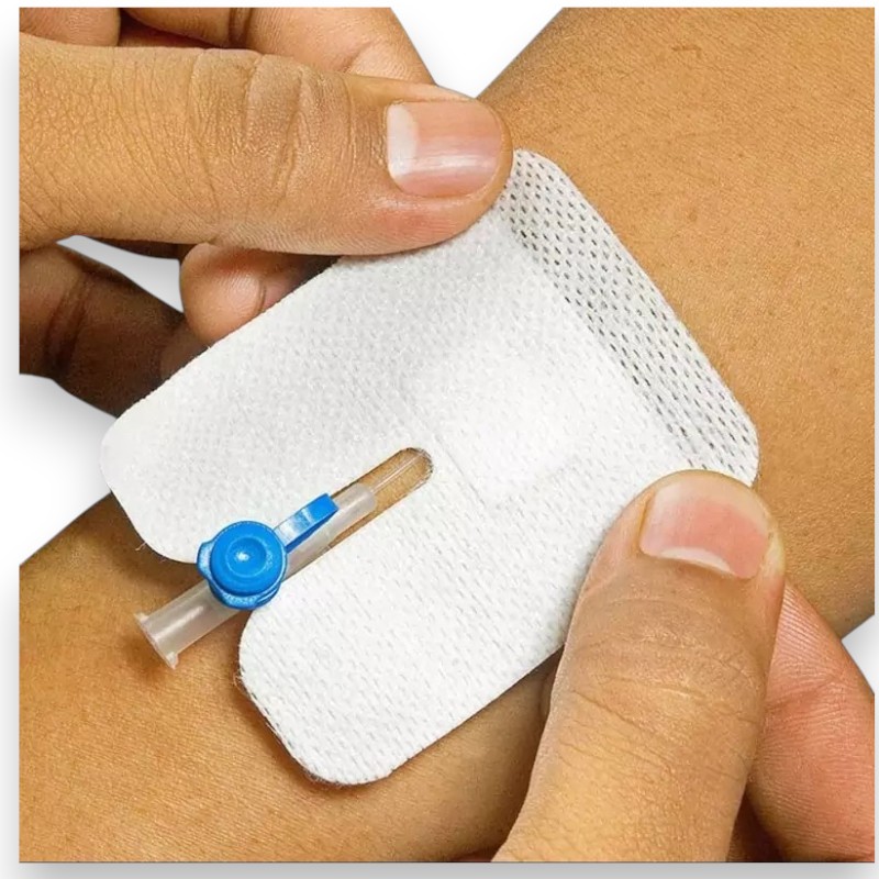 چسب آنژیوکت مدی باب بسته 100 عددی - Image 3